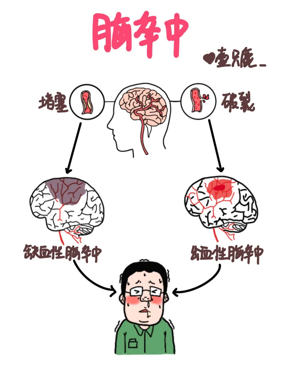 医学生笔记📒｜脑卒中🧐