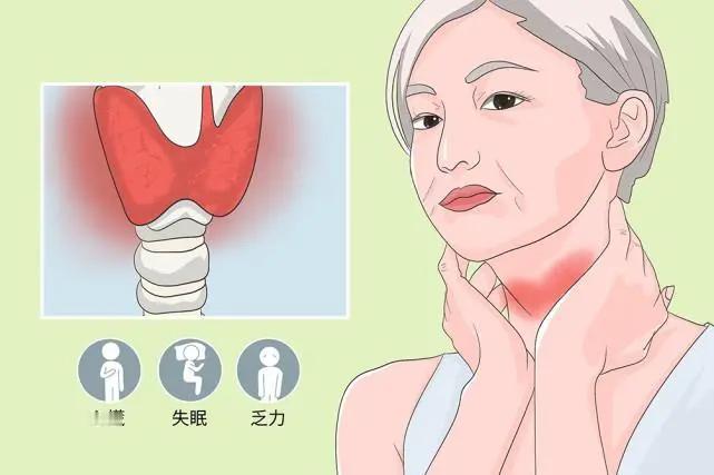 远离甲状腺疾病，这些最基本的知识你应该知道

在我们日常生活中，有一种健康问题逐