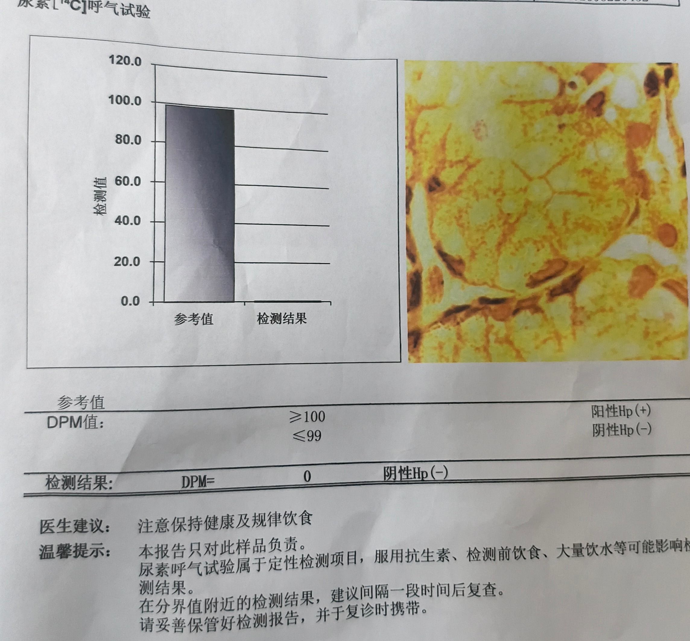 最近老是在外面吃吃喝喝，检测结果竟然0