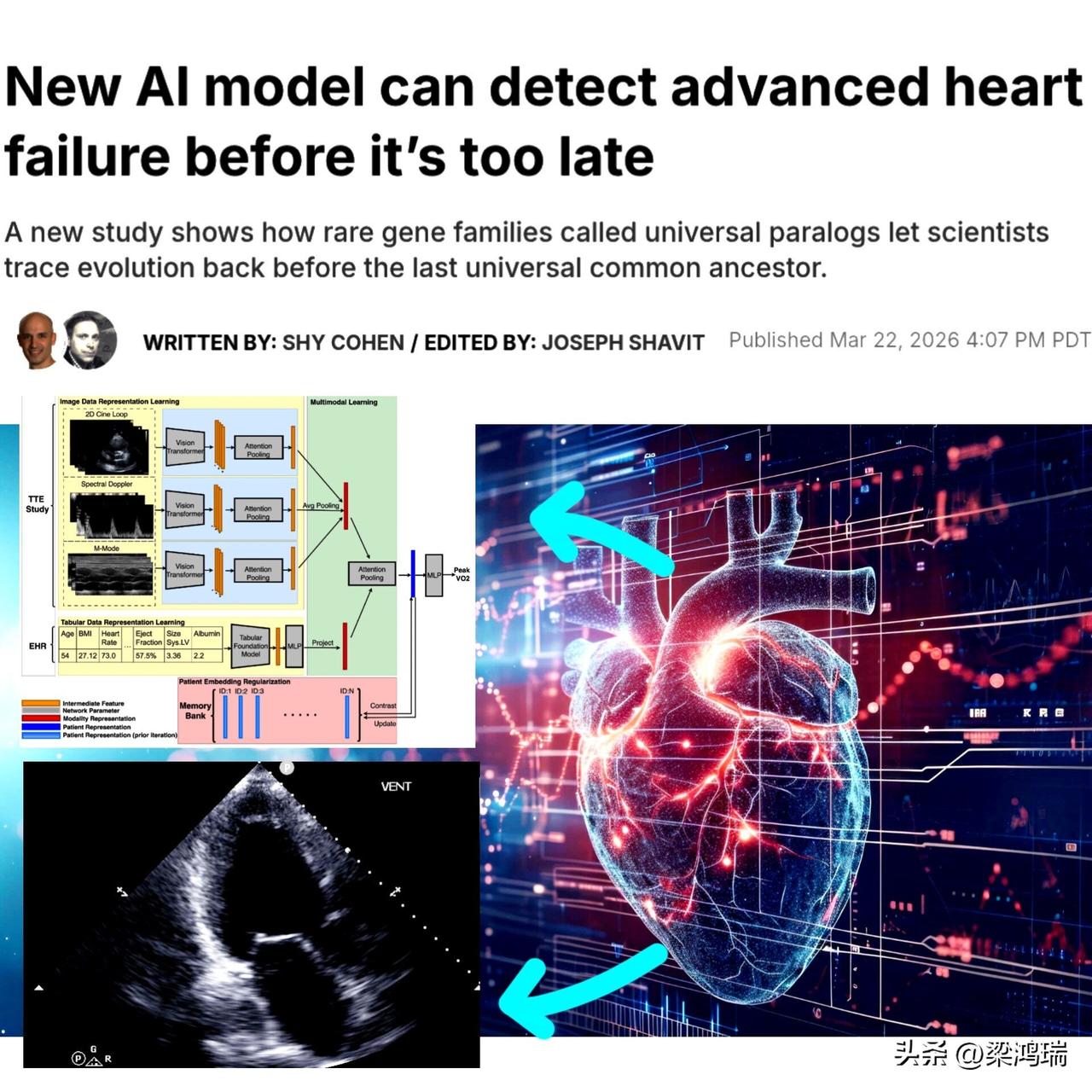 美国心力衰竭研究有新突破

这项研究由康奈尔大学（Cornell Univers