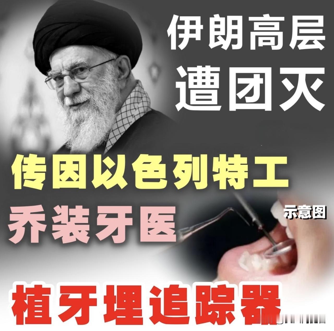 【伊朗高层团灭，传因以色列特工乔装牙医放追踪器】

美国和以色列联手对伊朗展开空