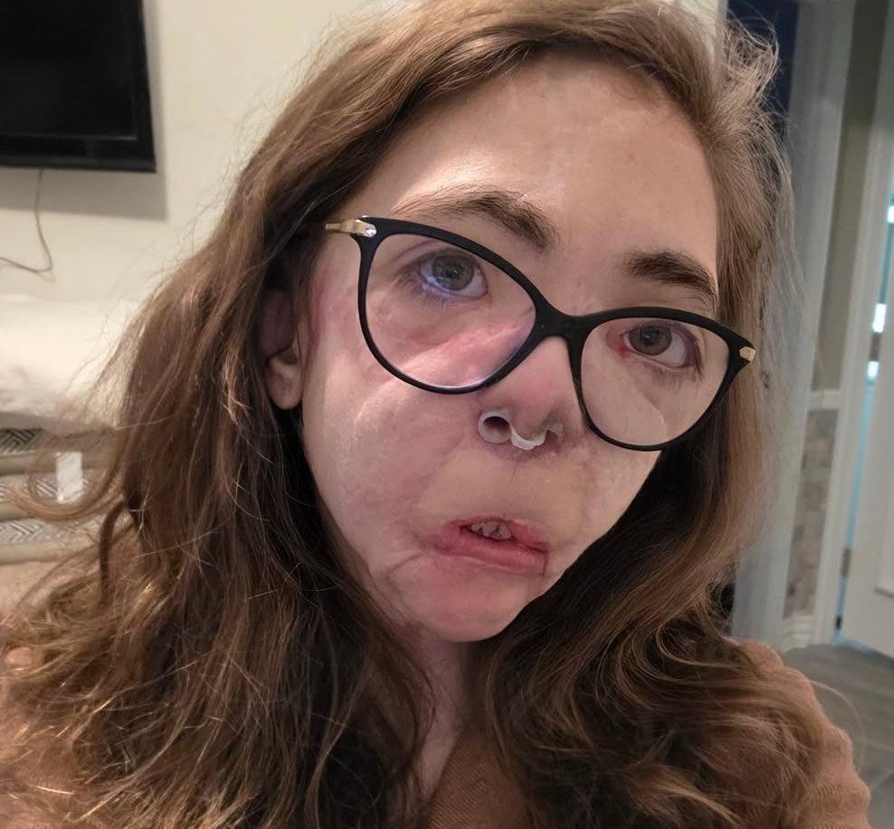 一位22岁的女大学生应朋友之邀出门遛狗。
她刚打开门，两只凶猛的恶犬就对她展开了