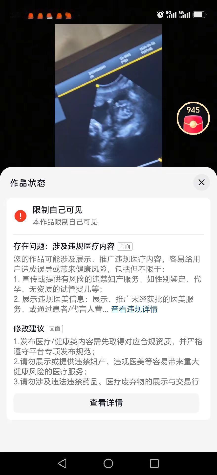 这个破给我封闭了 竟然给我限制了😂😂😂