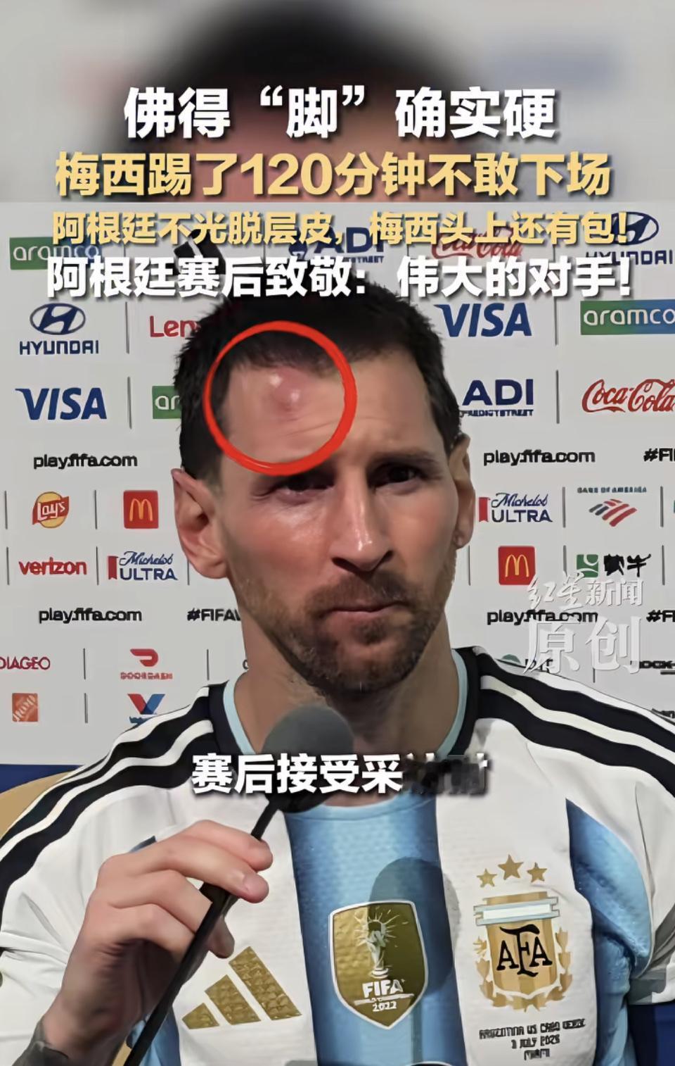 佛得角把梅西脑袋整挺大个包[捂脸]佛得角厉害了，梅西也夸赞了佛得角。 罗伯托·梅