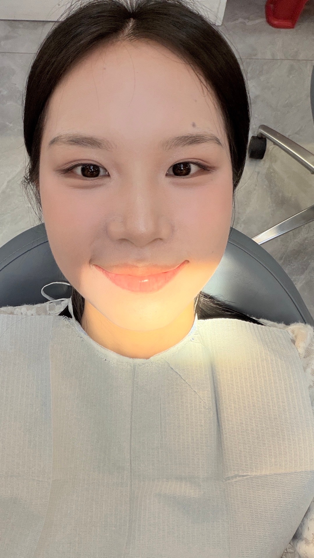 我今天摘牙套喔哦哦哦哦哦 