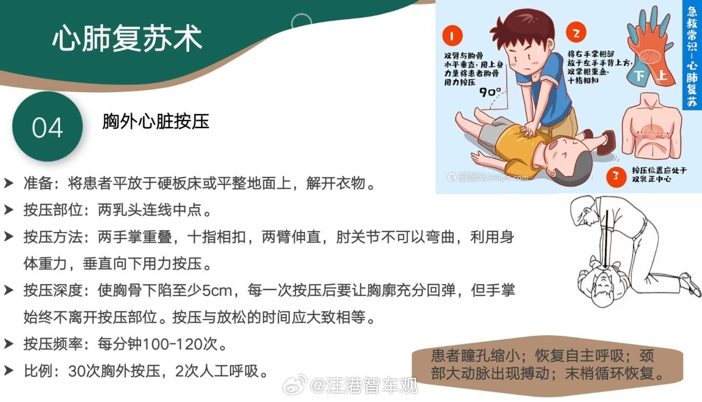 一路走好！心脏骤停(cardiac arrest)是指心脏射血功能的突然终止，大