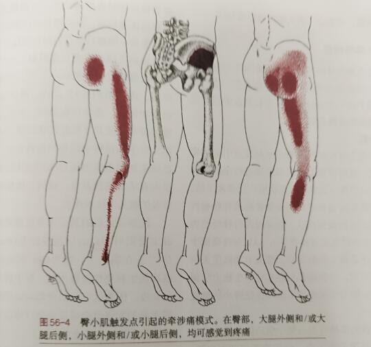 臀小肌表现