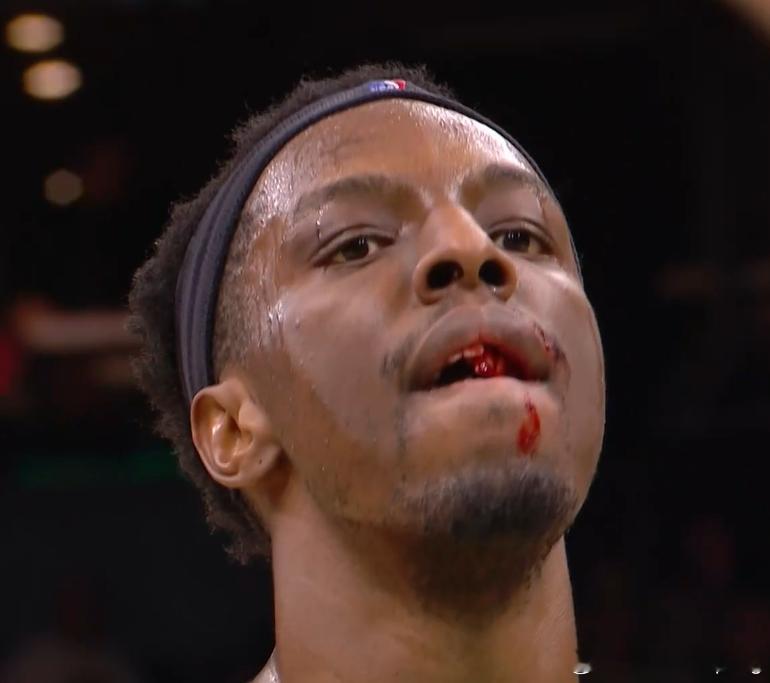 血腥警告！奥孔武牙被杰伦布朗一肘打歪了NBAnba吐槽大会