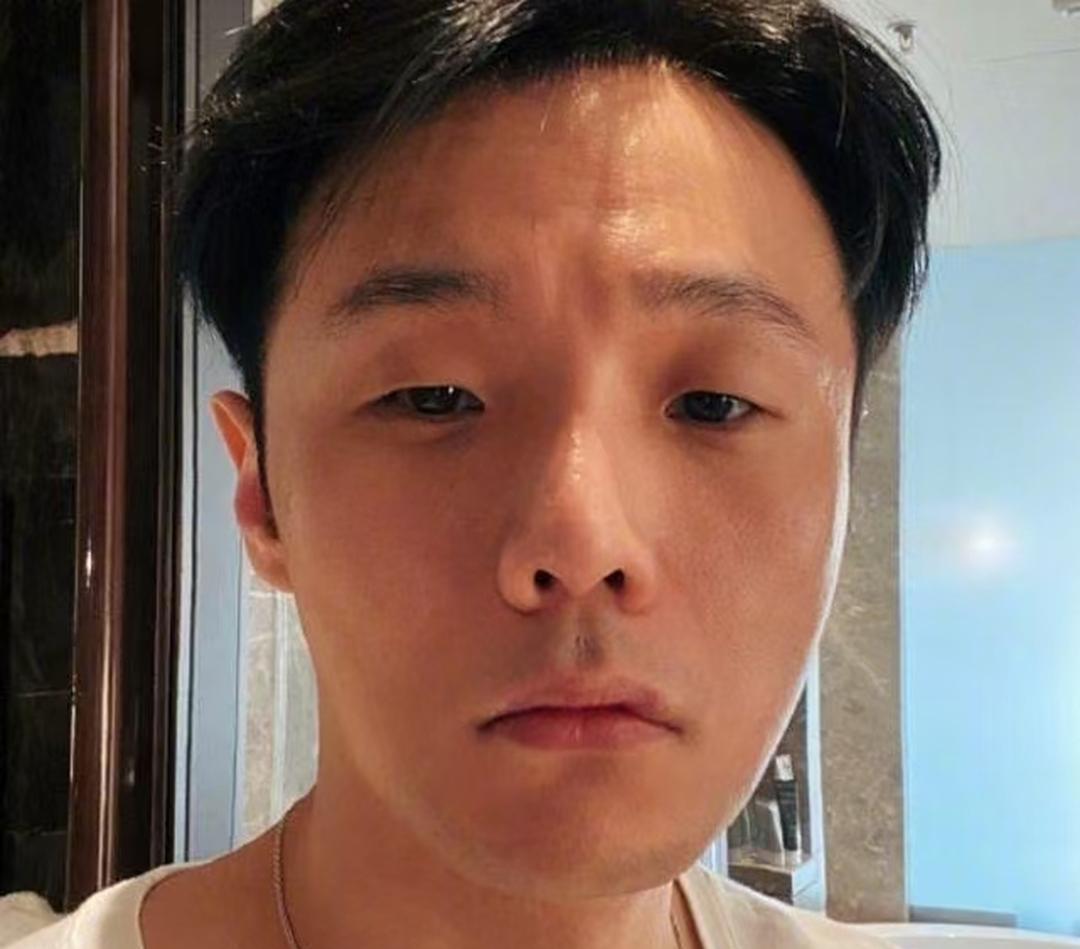 李荣浩割了双眼皮后，颜值确实一下子提升了不少，但也少了以前那种让人一眼就能认出他