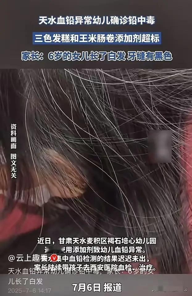 发指！六岁孩子白发苍苍！我还纳闷，一个幼儿园这么大本事，能让医院出假报告，能让当
