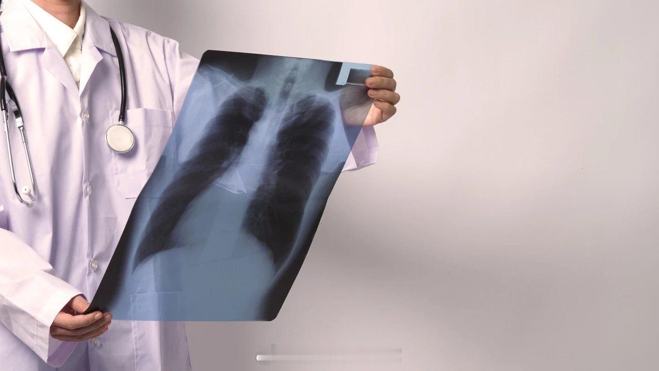 关注生活 关注健康一文讲透！胸片和CT，体检到底怎么选？辐射怕不怕？多久查一次？