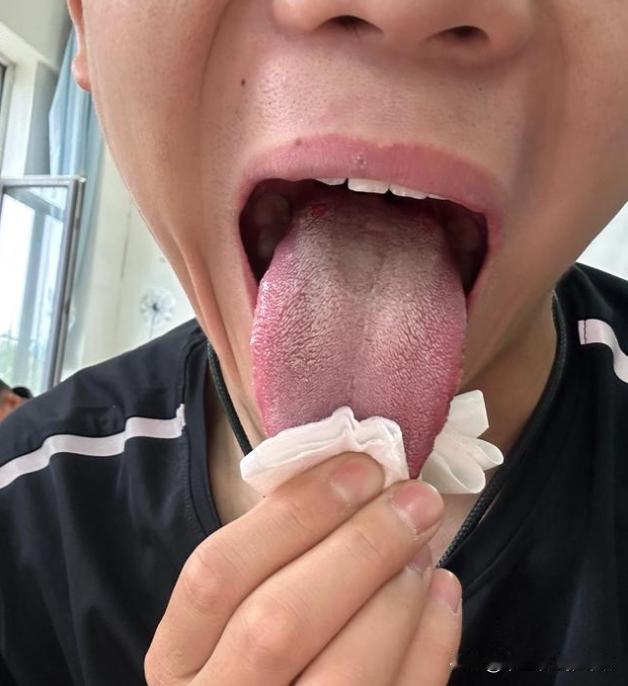 20出头大学生，这身体，也确实不咋地啊[黑线][黑线][黑线]
怪不得都说，现在
