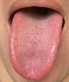 男性状态不佳？调理核心：补阳、通络、疏肝





很多朋友只要是出现了宗筋质量