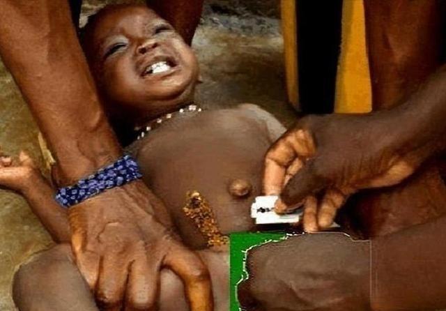 非洲有一项存在了3000多年的陋习。女孩5岁时，在没有麻醉的情况下，被女性长辈用