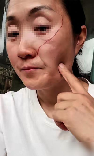 株洲高考母女的母亲，很愚蠢，也不值得同情。

我家楼下前两年就出过一模一样的事，