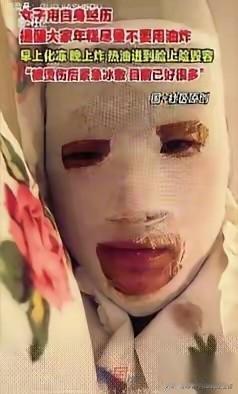 安徽一姑娘的年糕“炸弹”事件！ 

  因为嘴馋想吃炸年糕，就把冻年糕拿出来化冻