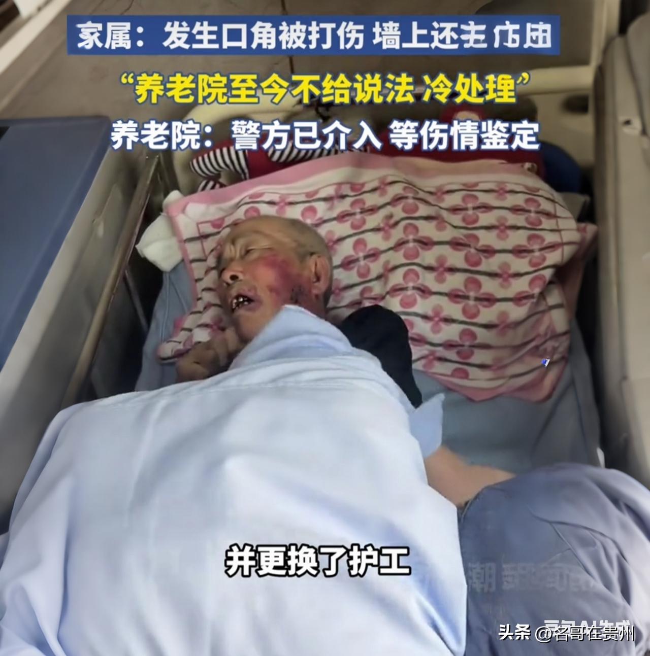 80岁瘫痪老人遭护工酒后殴打，养老院竟装死：谁来买单？🤬

太气愤了！真的，看