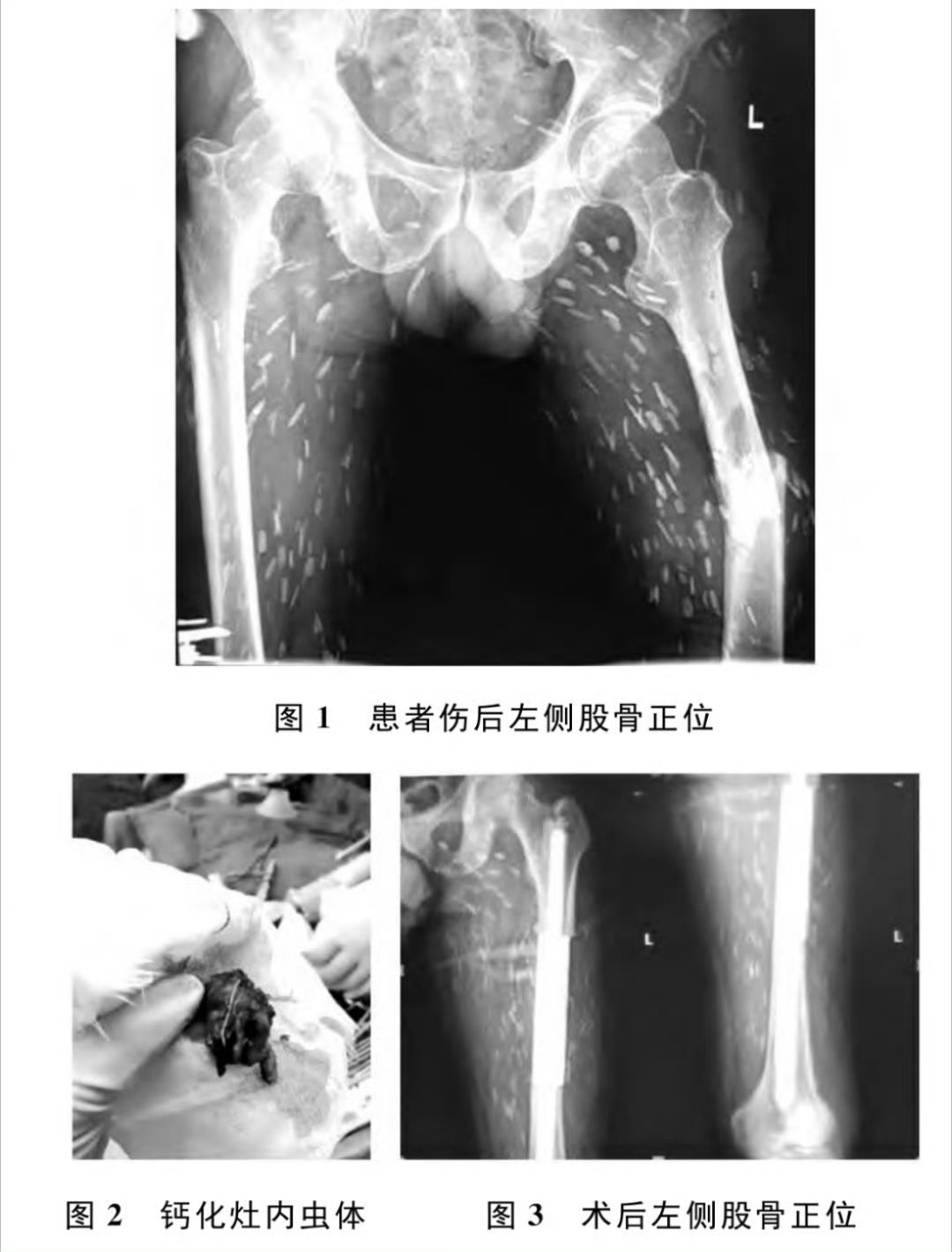不要生吃或半生吃猪肉牛肉大图慎点。一个喜欢吃生猪肉的大爷。¹ 虫子可以寄生在脑子