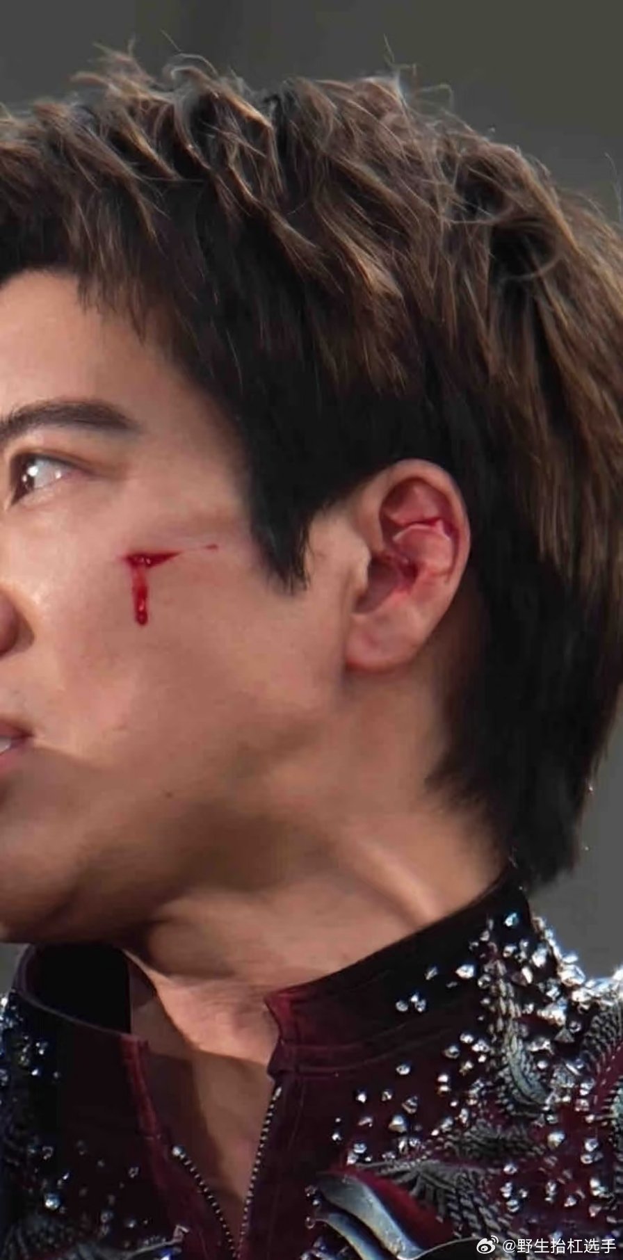 王力宏左耳受伤 王力宏摔倒，左耳受伤了，看起来像割了一道…… 