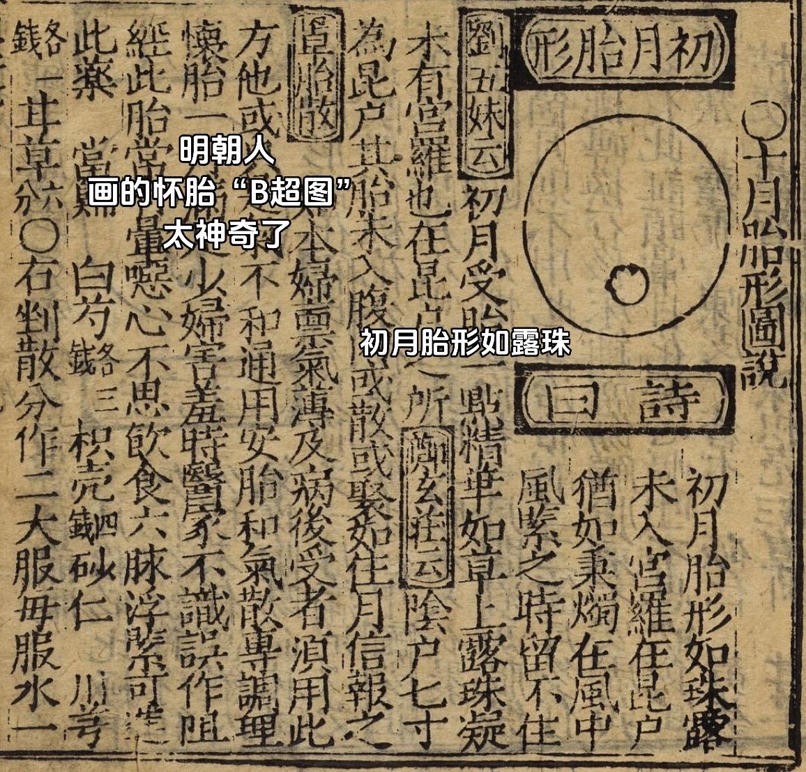 明朝人画的十月怀胎“B超图”，胎形如此清晰 古人太厉害了，号脉就可以确定男孩女孩