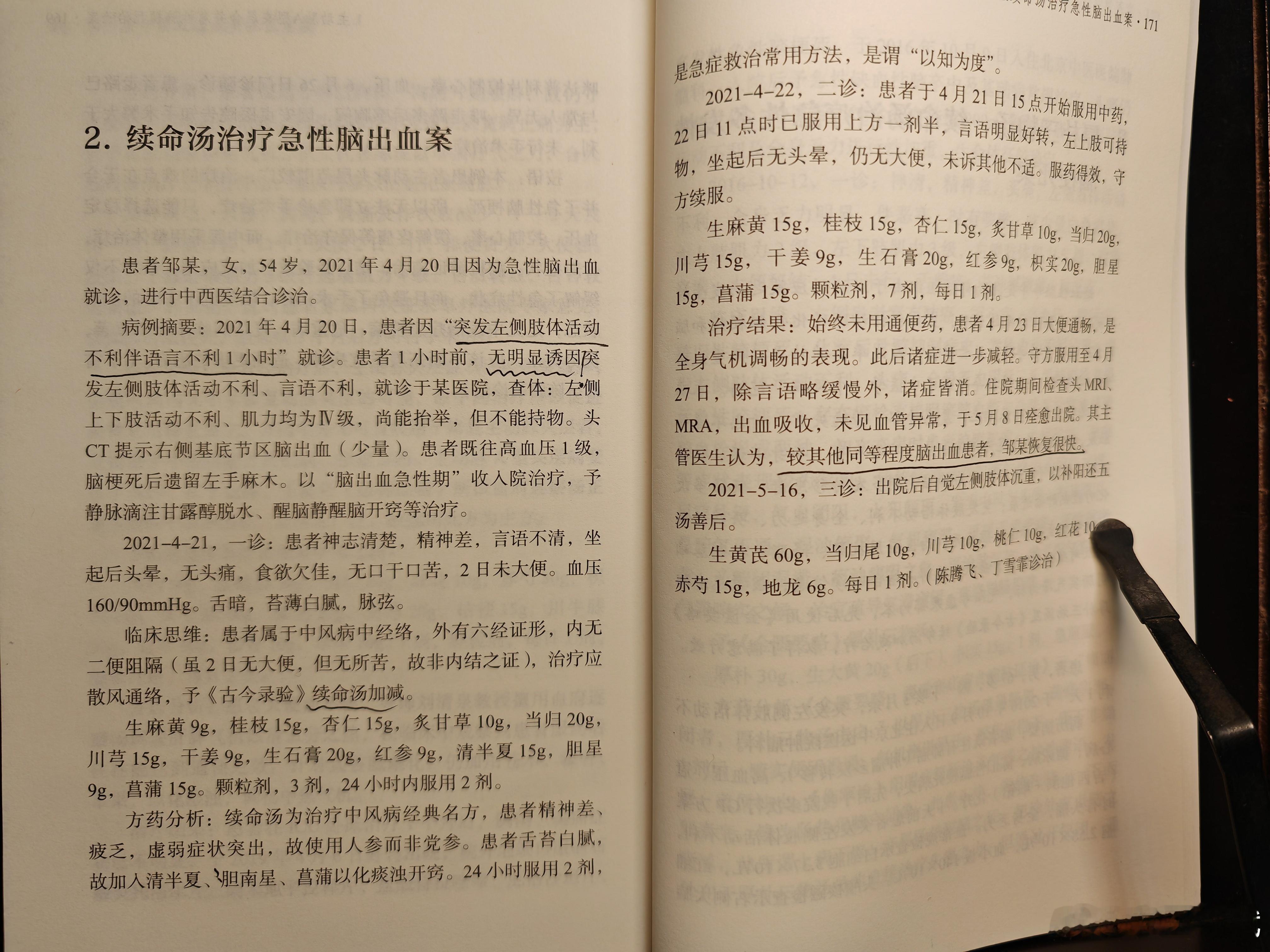 急性脑出血用续命汤加减，住院不到二十天就出院，是很漂亮的案子。就是现在写病历似乎