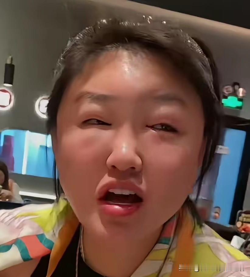 咱就说整成这样了，就不能歇两天再出来吗？
也真是不把网友当外人，光鲜的，亮丽的，