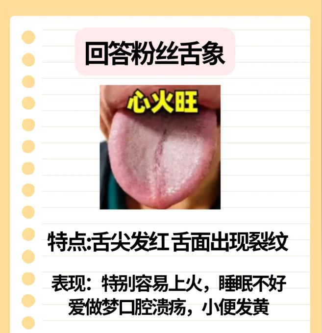 中医舌诊辨证论治~气郁、阴虚、心火旺，分别有哪些具体的症状表现？对照看一看！