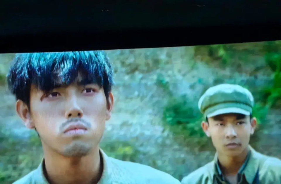 阿瑟嘴这是怎么了？角色设定还是？ ​​​