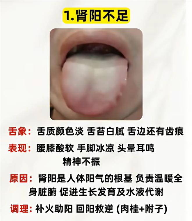 阳气亏虚分三类，从舌头分辨心脾肾阳虚对应的身体信号