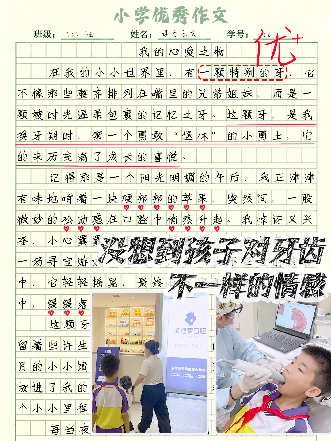 优秀作文分享《一颗牙》海狸家守护宝贝笑容