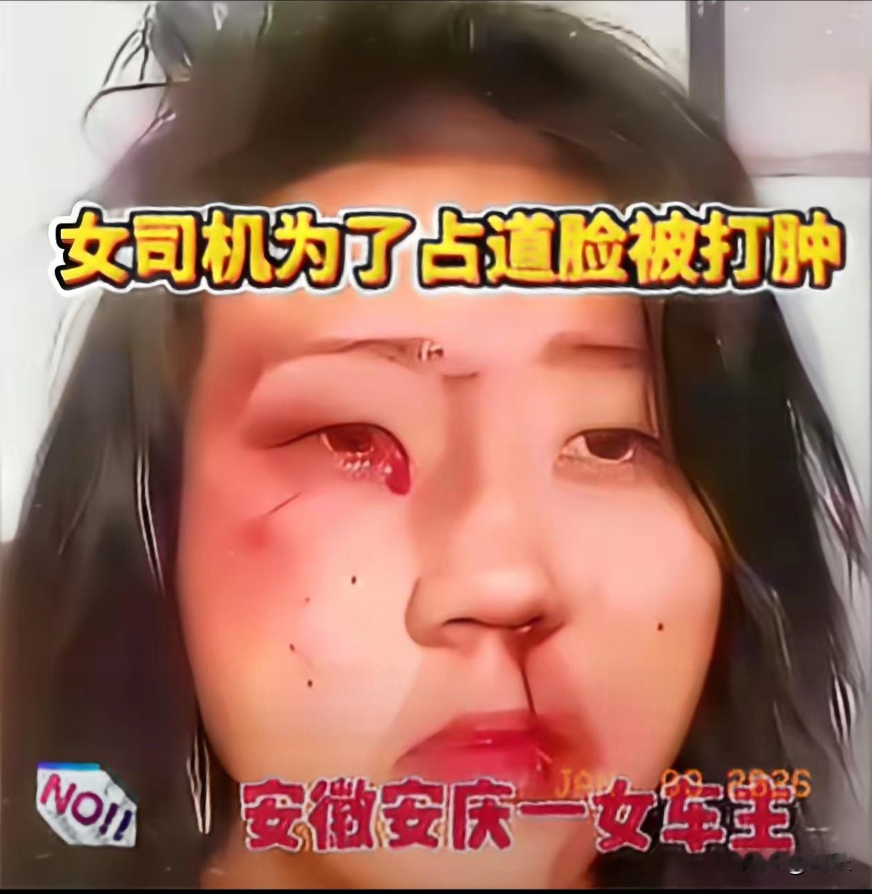 国道被龟速车堵了10公里，前车大姐开28码还热火朝天地打视频，完全不管后车喇叭震