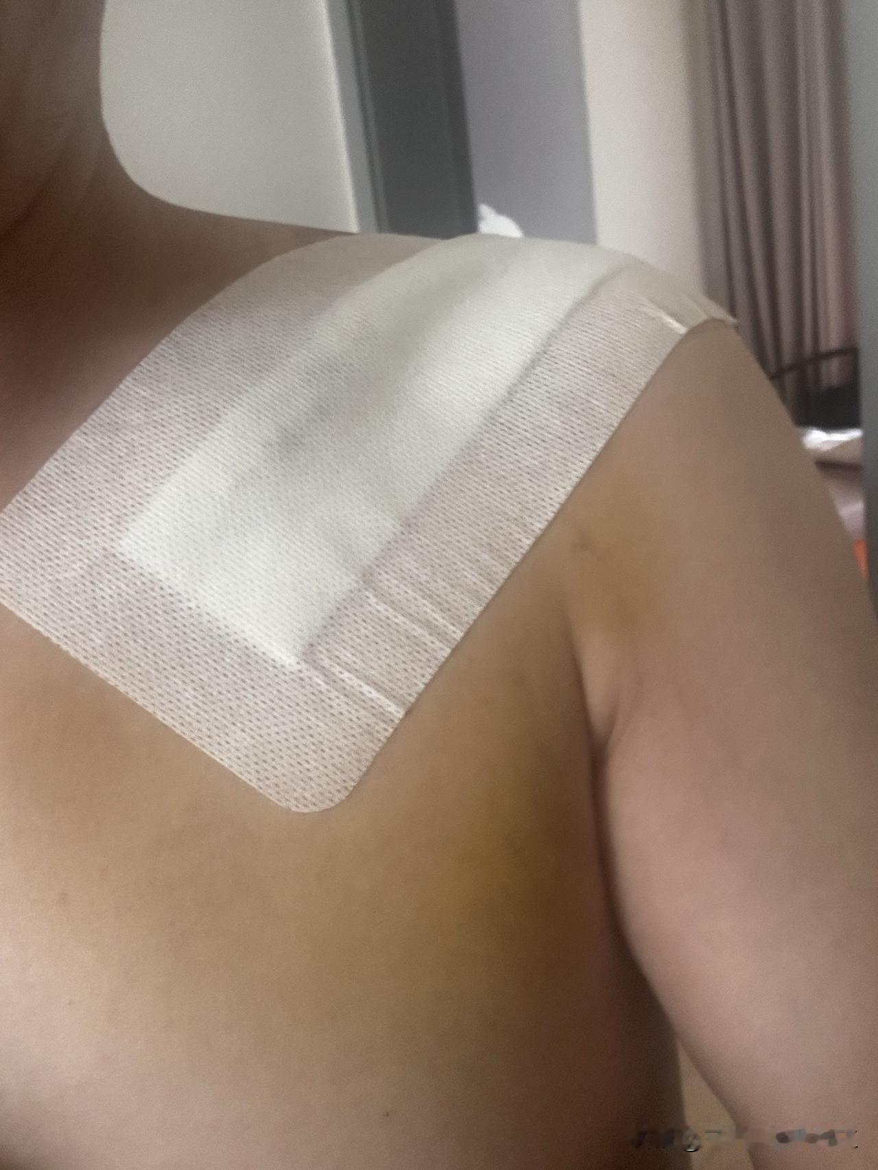 踢球被撞伤，做手术医保报销后被自己花了近一万元，是否要让对方承担这部分医药费？在