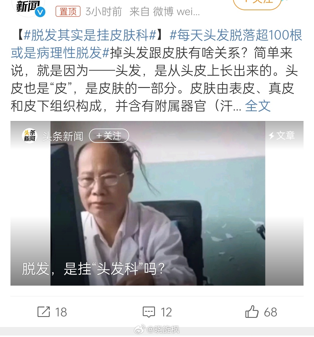 【#脱发其实是挂皮肤科#】蜥蜴永远无法改变头痛治头脚痛治脚的现状！蜥蜴治疗脱发不