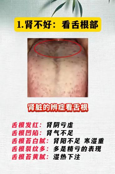 看舌头辨五脏，这几个部位一定要看