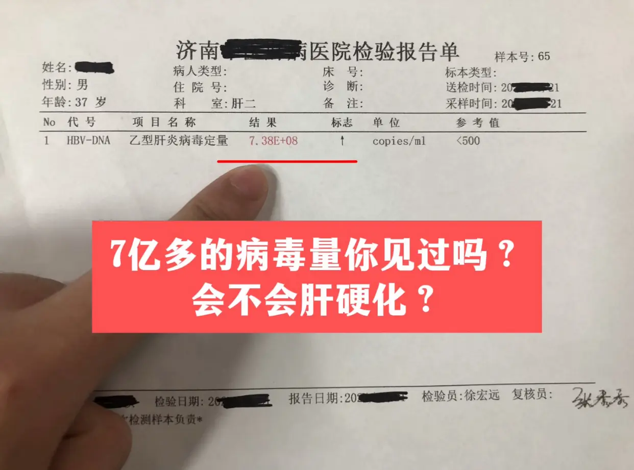 门诊上遇到山东 37 岁的李先生，一查病毒量高达 8 次方，体内有7亿...