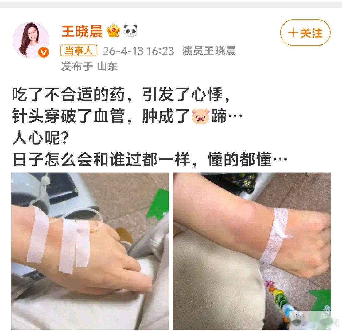 王晓晨发文透露，由于吃了不合适的药引发心悸，并晒出一组就医照，手背上贴着胶带，有