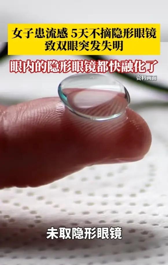 福建宁德，一女子流感期间，竟连续5天没摘隐形眼镜，结果某天早上醒来，突然眼前一黑