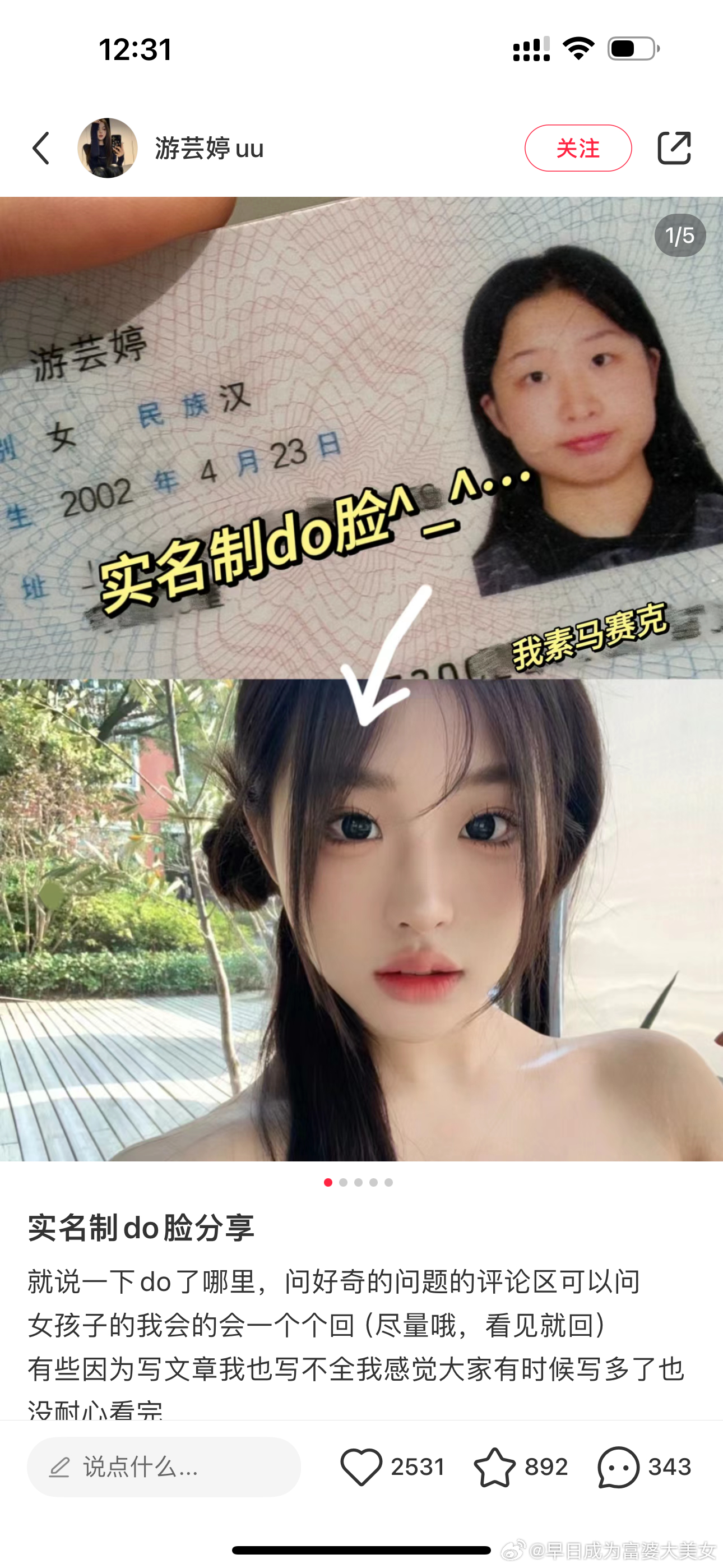 整容改变命运实例[doge]跟俺一样 ​​​