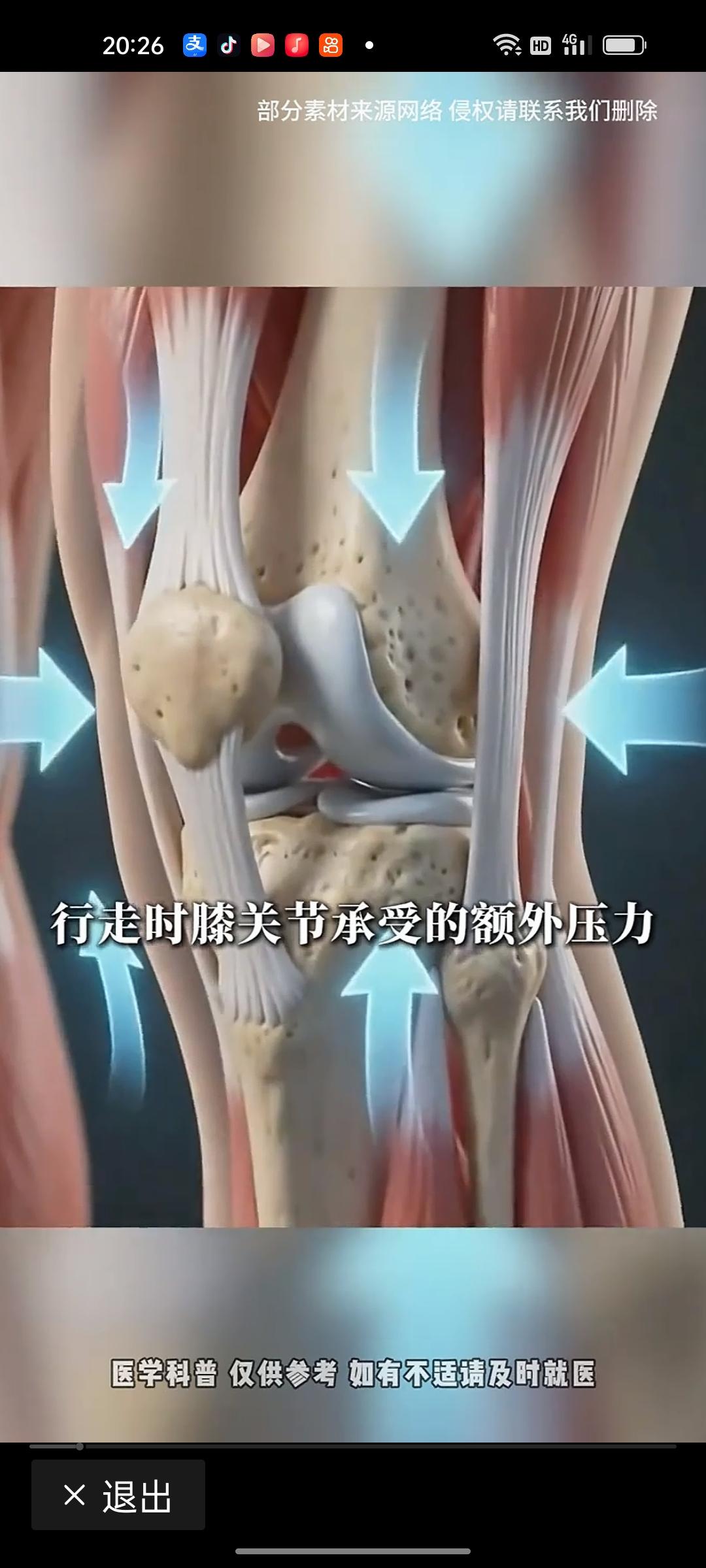 很多人潜意识里觉得，关节疼是老年人专属毛病。只要年纪不大，就不用操心膝盖、腰肩的