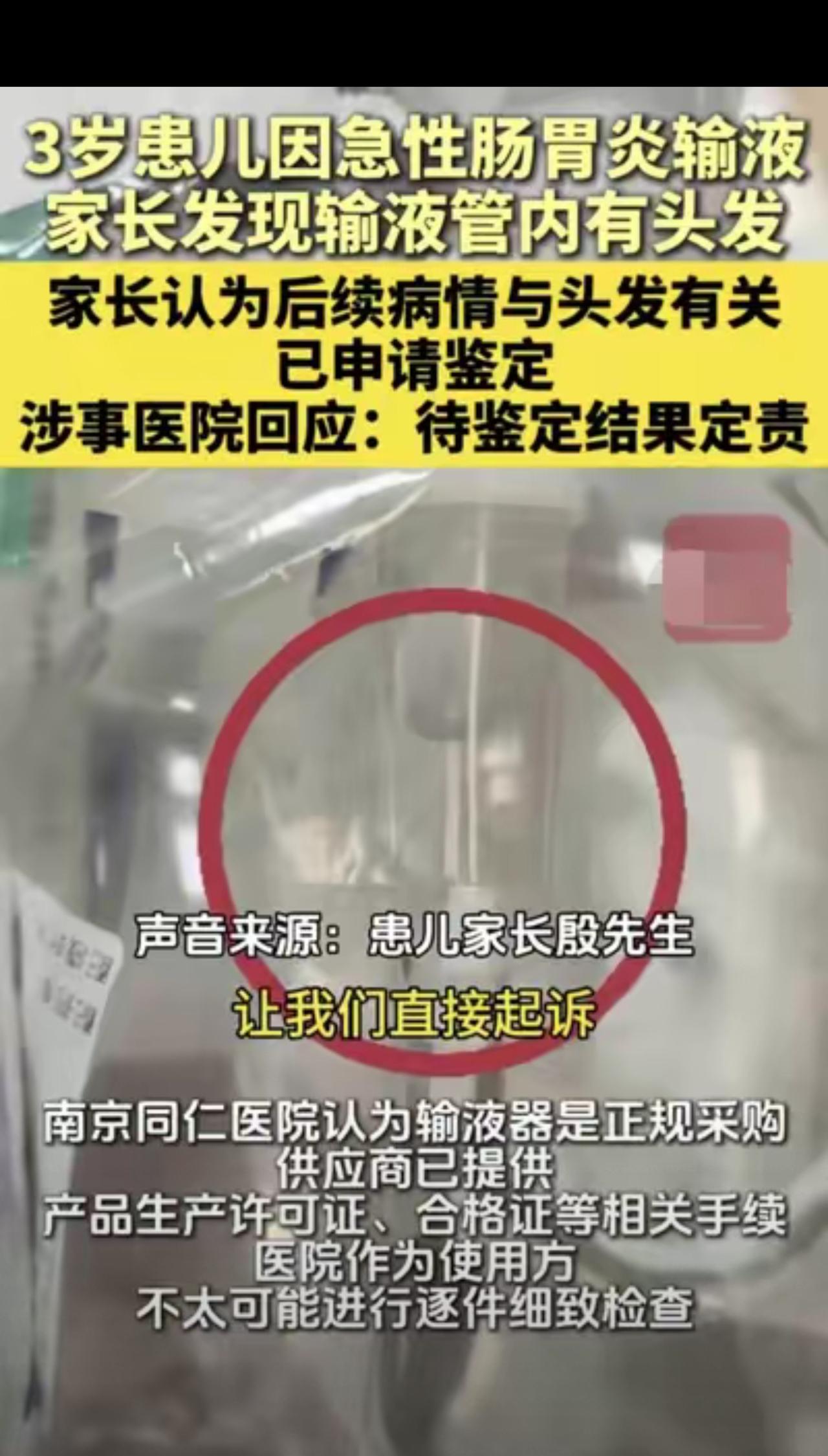 江苏南京，男子带3岁孩子在医院输液时，偶然发现输液管里有根头发，之后，孩子就有发