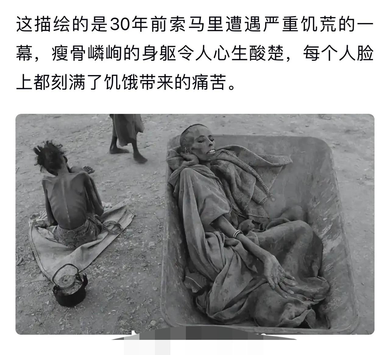 饥荒的残酷现实：瘦骨嶙峋的身躯，刻满饥饿的痛苦。