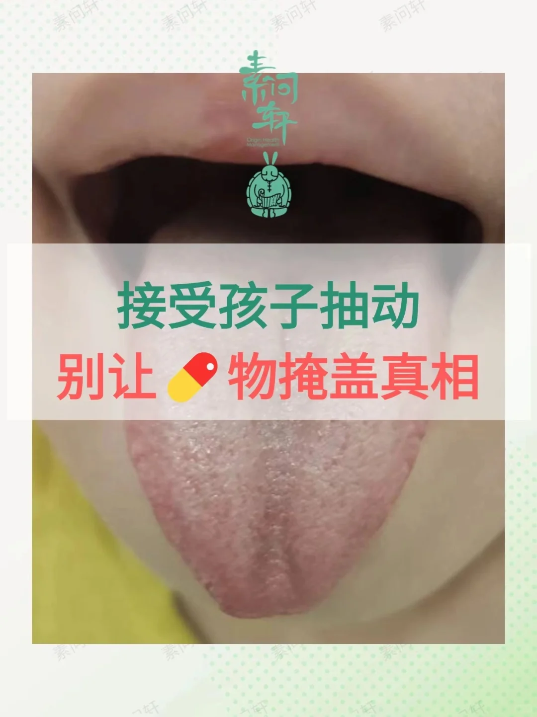 孩子抽动就让他抽动，没什么大不了的