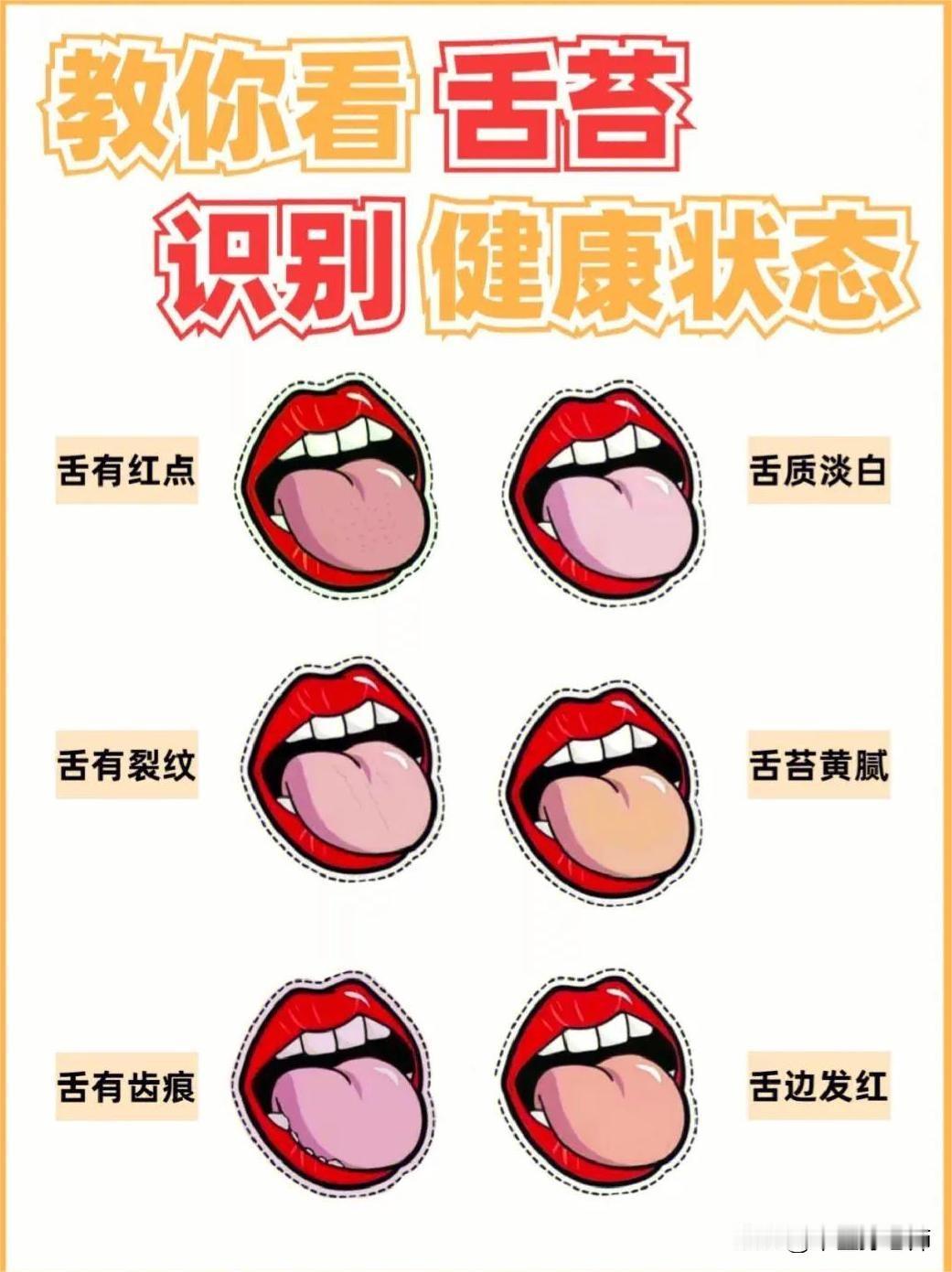 中医教你看舌苔，识别健康状态#健康##舌象#