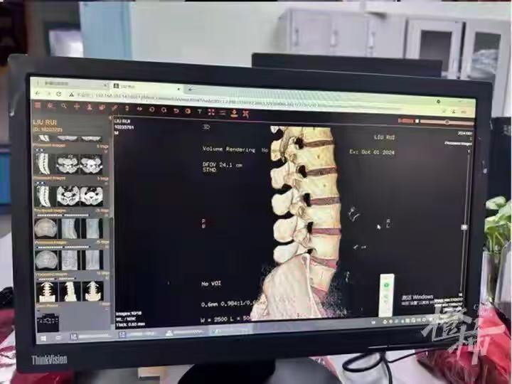 在海南参加冲浪培训，刚下水做了一个简单动作，就永久瘫痪了！

网友评论：
动作本