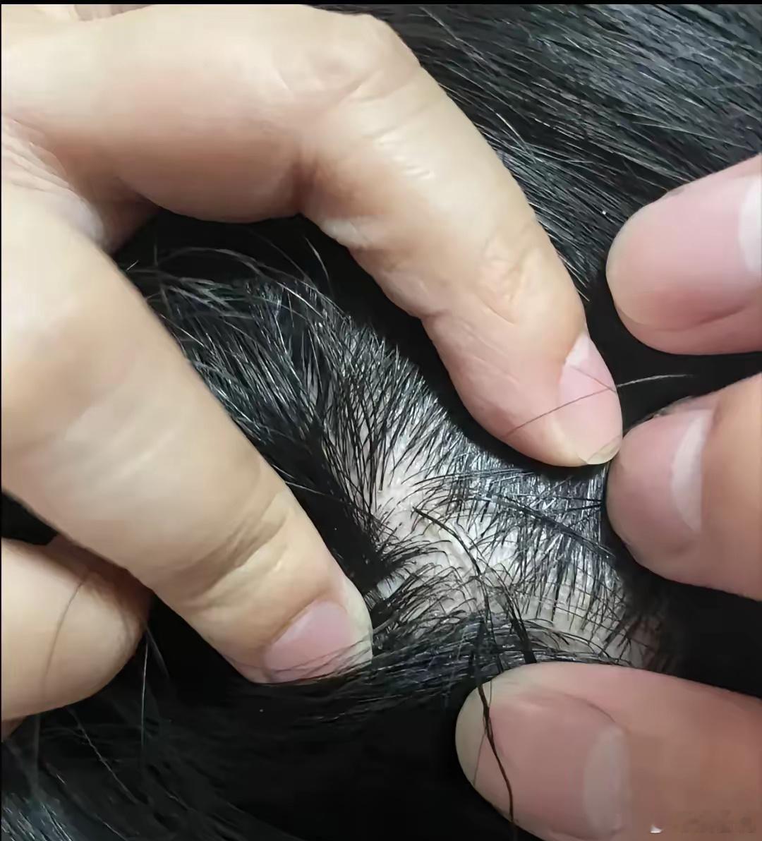 老公头上拔下来的头发，这一根很特别，想问一下这是咋回事？ ​​​