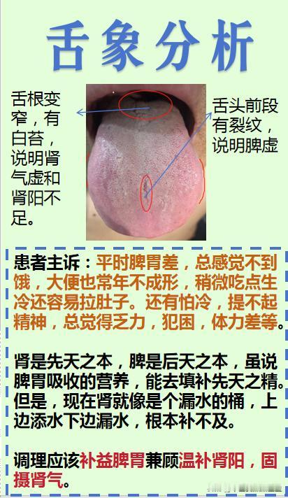 免费分析舌象！先发先分析！

继续分析舌象！

拍的清晰，分析准确！

#中医#
