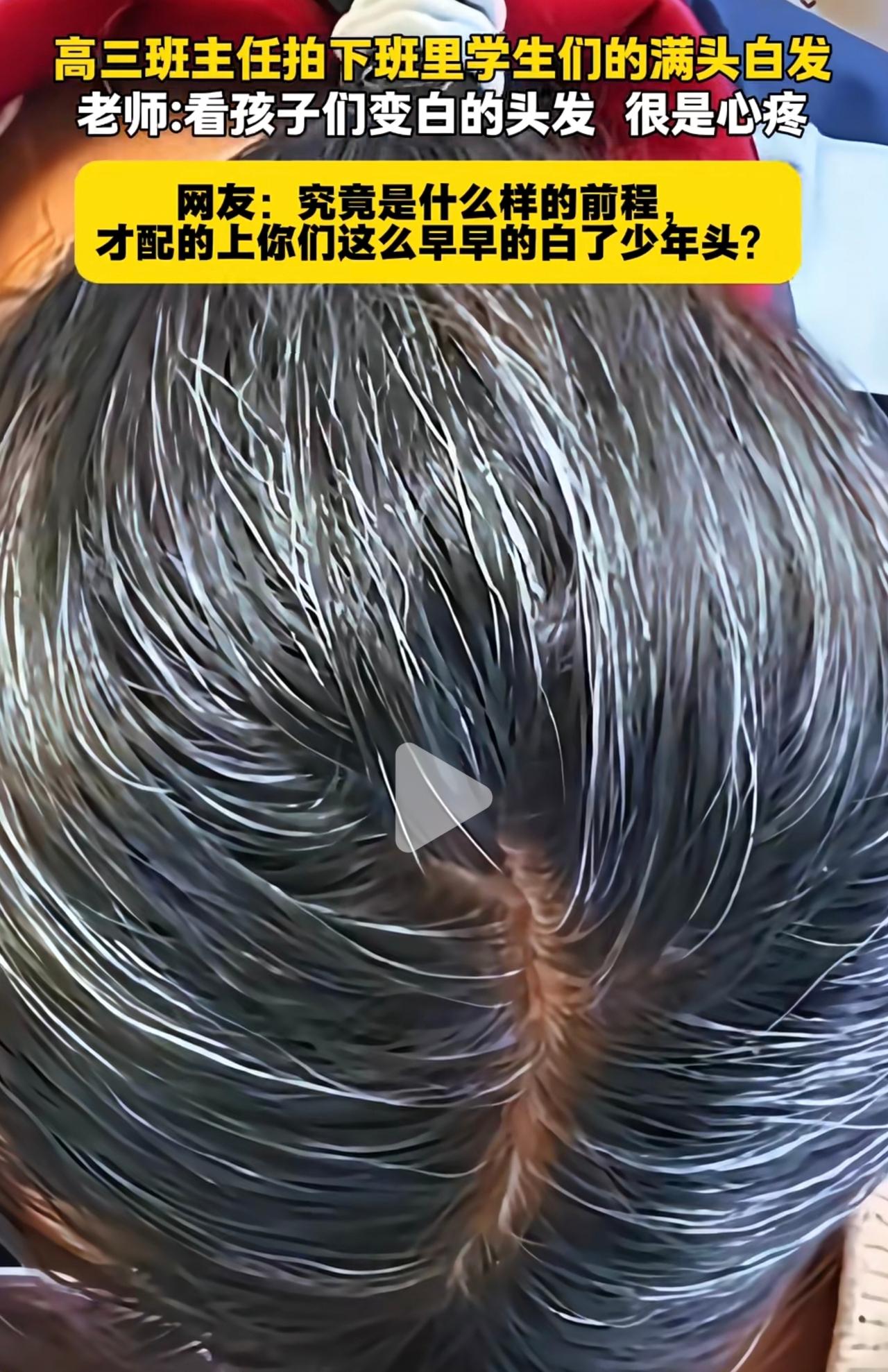 有个高三班主任看到满教室他的学生，十七八岁正是朝气蓬勃的时候，看一头白发，实在揪