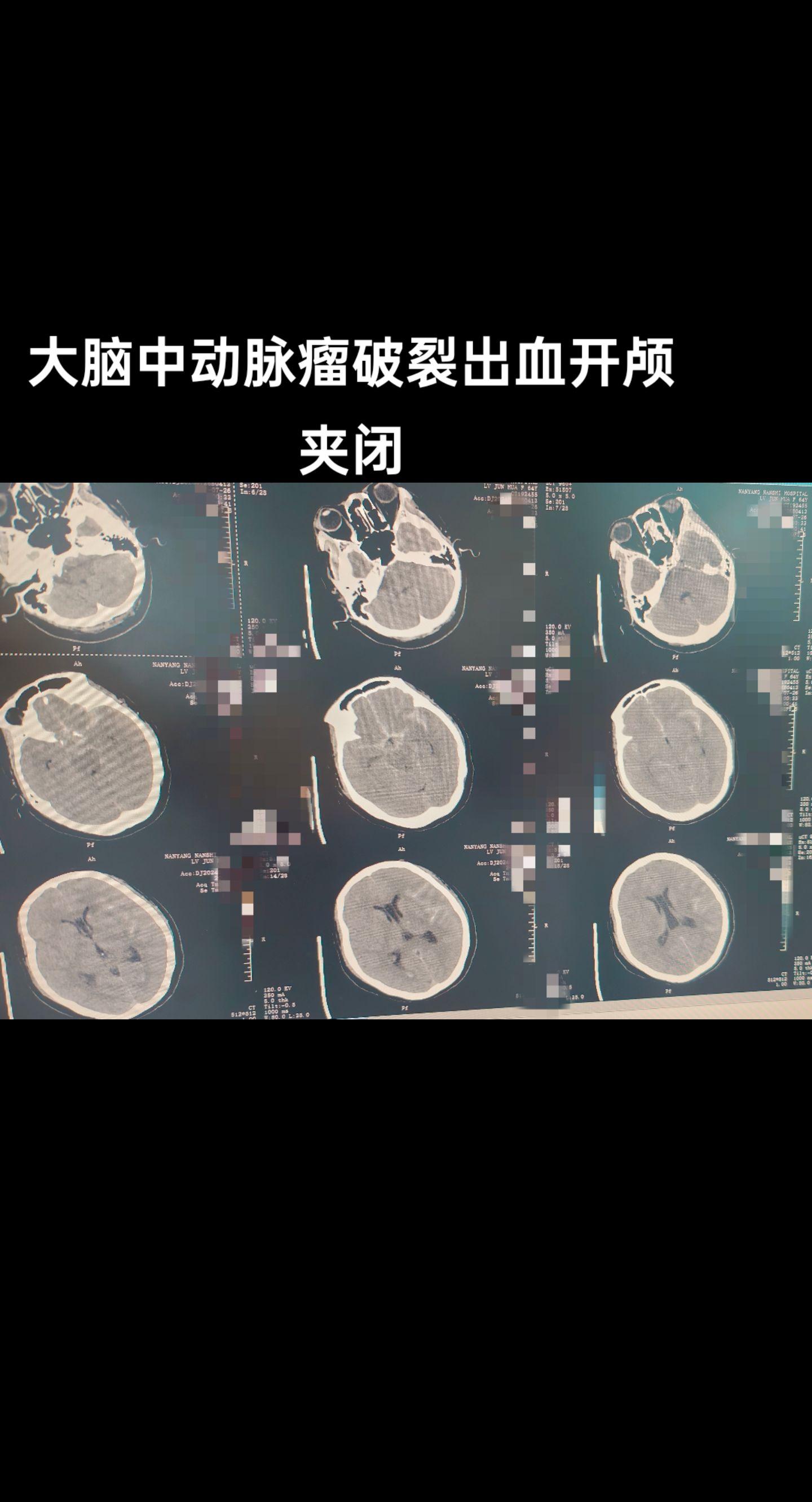 医学科普 手术室日常 医生日常 医者仁心