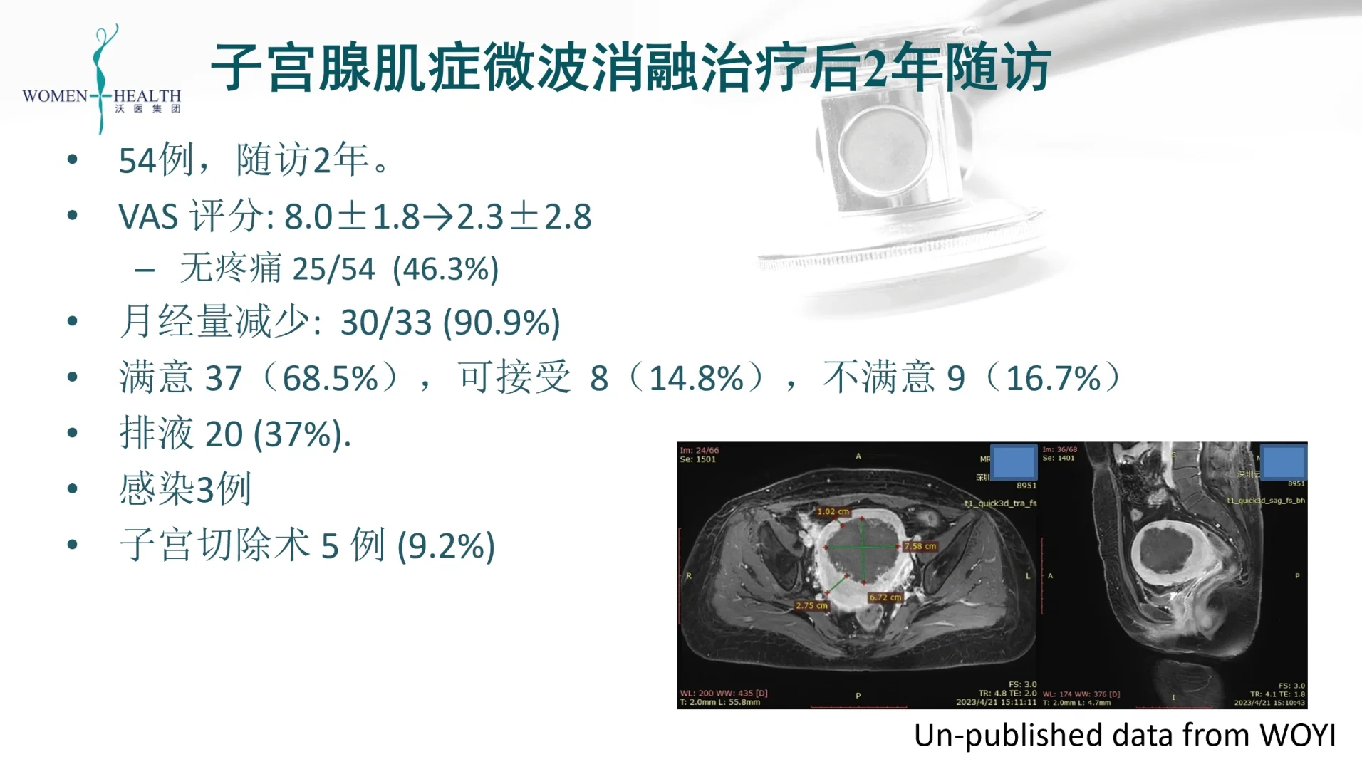 子宫腺肌症做超微创微波消融有效吗