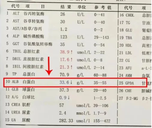 肝功能上这个数值低于30，警惕肝硬化！